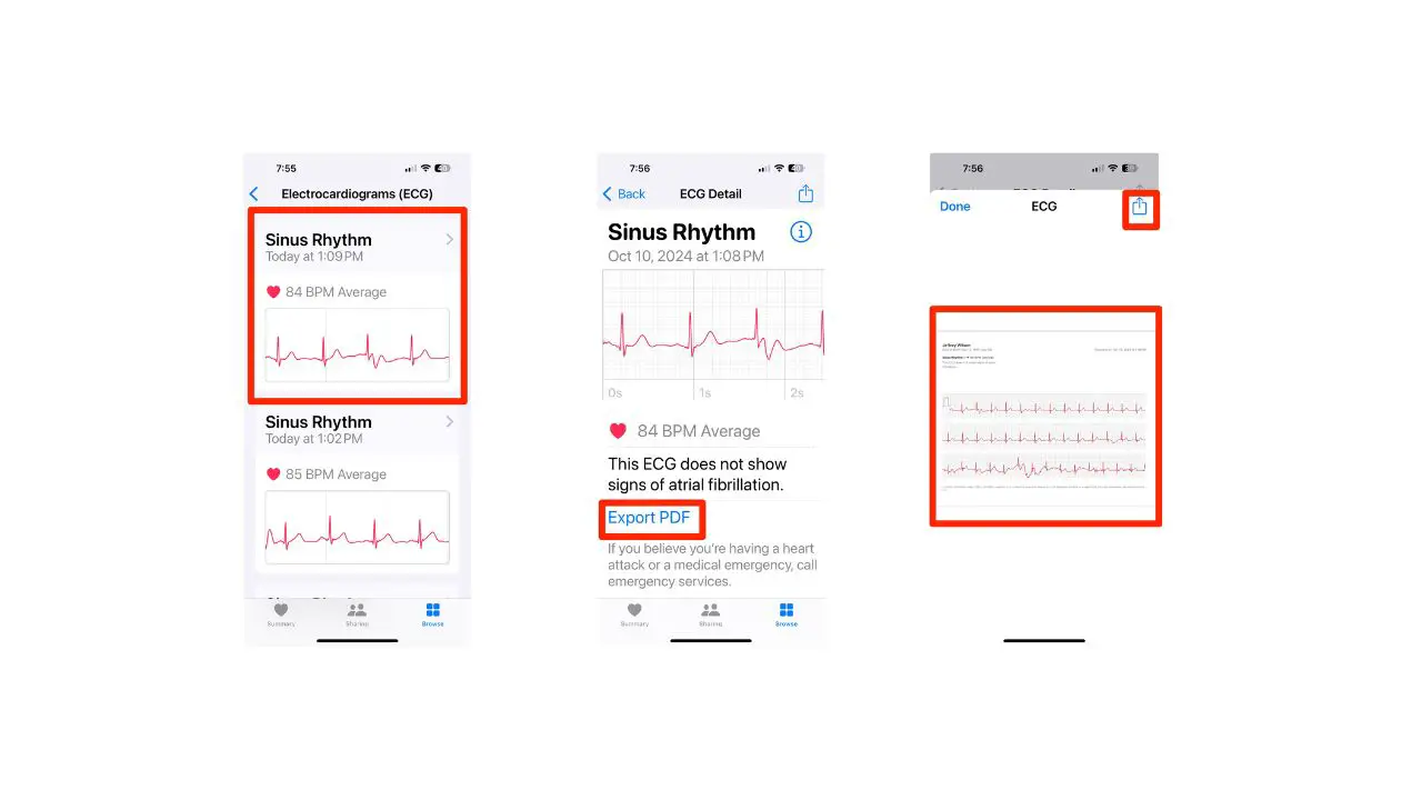 share apple watch ecg share apple watch ecg
