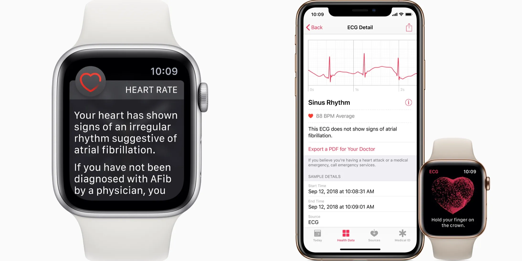 apple watch afib